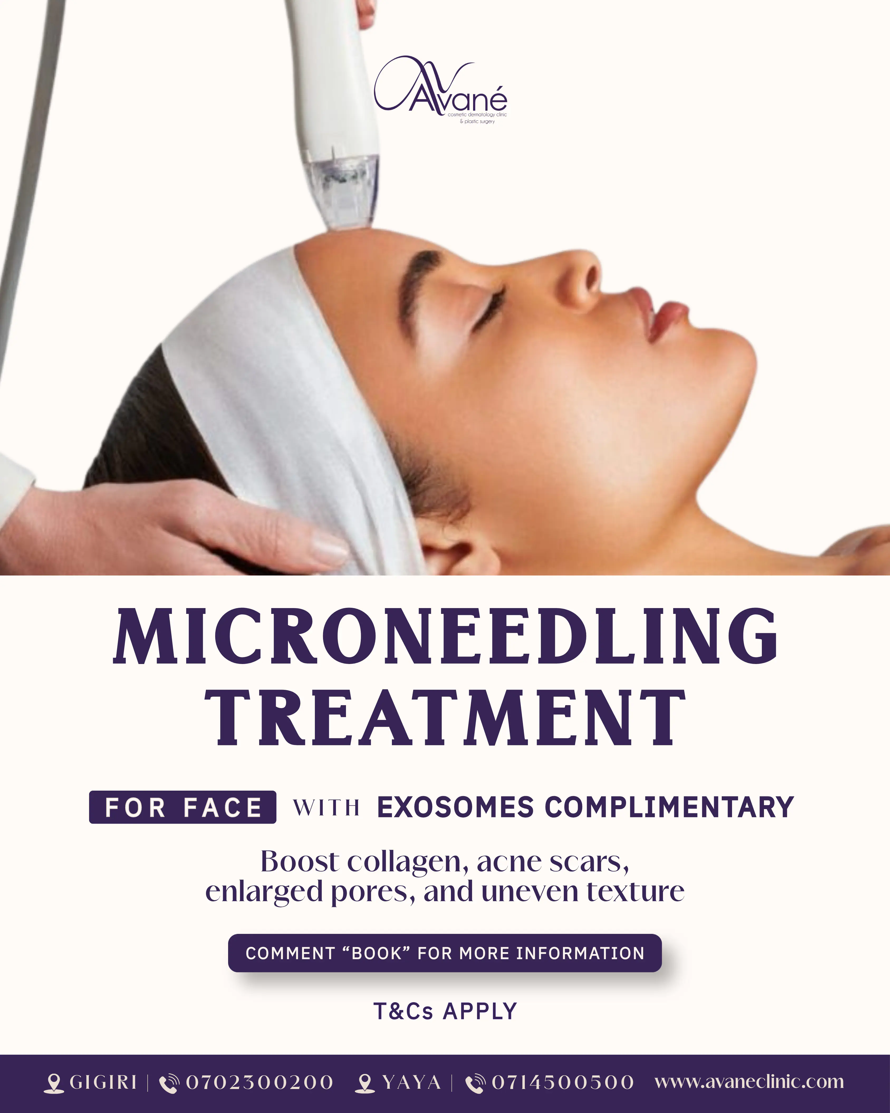 Microneedling with exosomes April offer